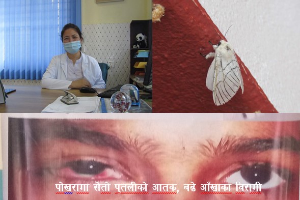 गण्डकीमा आँखा पाक्ने सापु रोगका बिरामी बढे